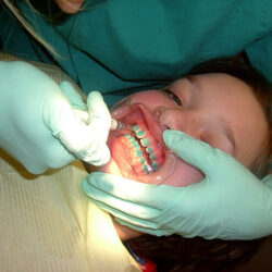 Why Do People Think Blue Teeth Are a Good Idea?