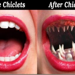 Miracle Gum Grows New Teeth