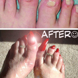 Perfect Nails Made Easy: 8 Feet in 8 Weeks